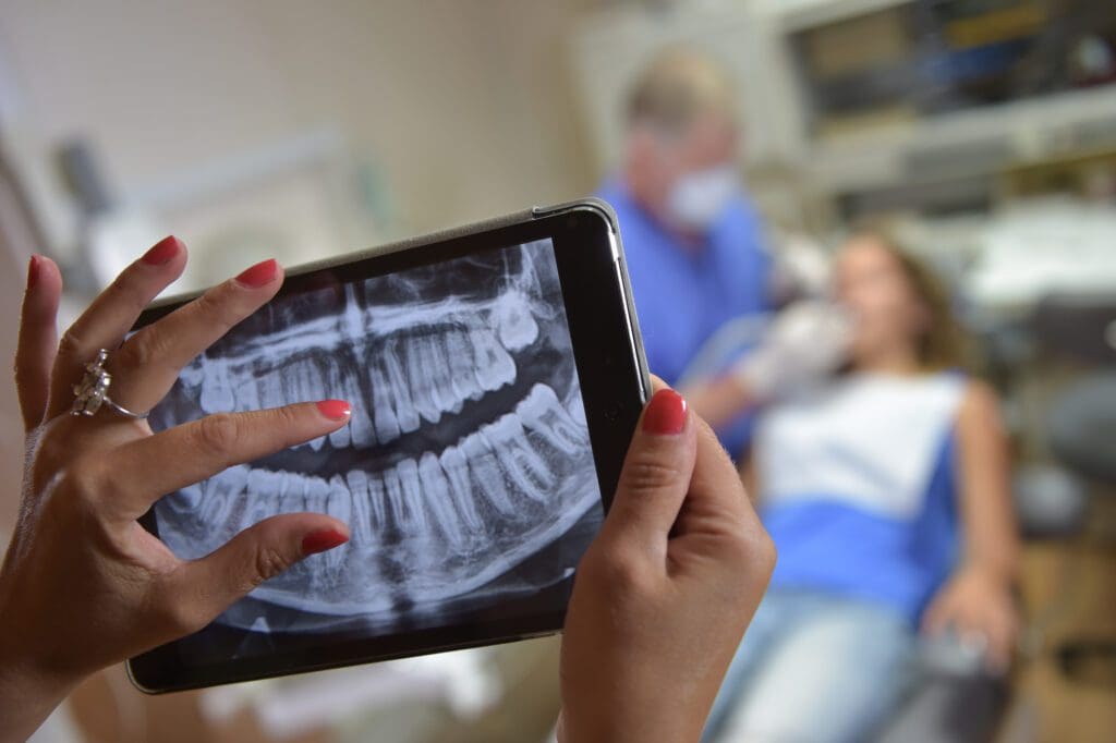 Tooth Extraction in Washington, DC