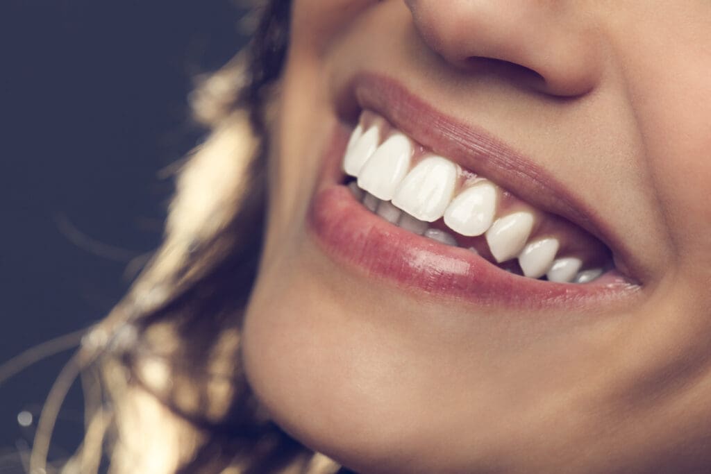 PORCELAIN VENEERS in WASHINGTON DC are a versatile treatment option for many dental concerns.